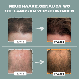 Aktivator +  GRATIS Shampoo