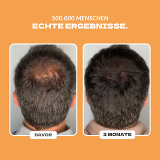 Aktivator +  GRATIS Shampoo