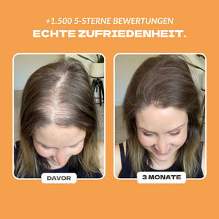 Aktivator +  GRATIS Shampoo