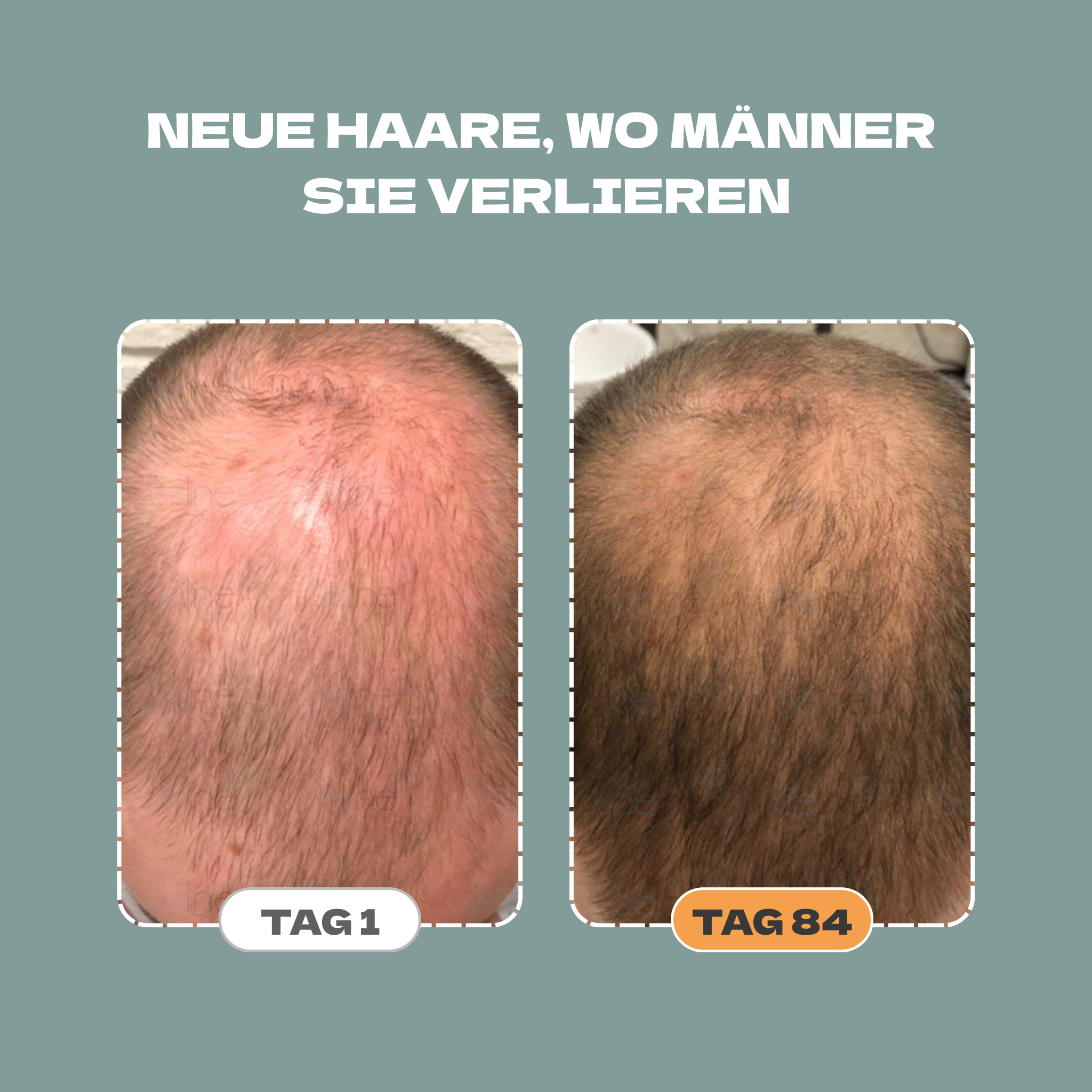 Shampoo + Serum