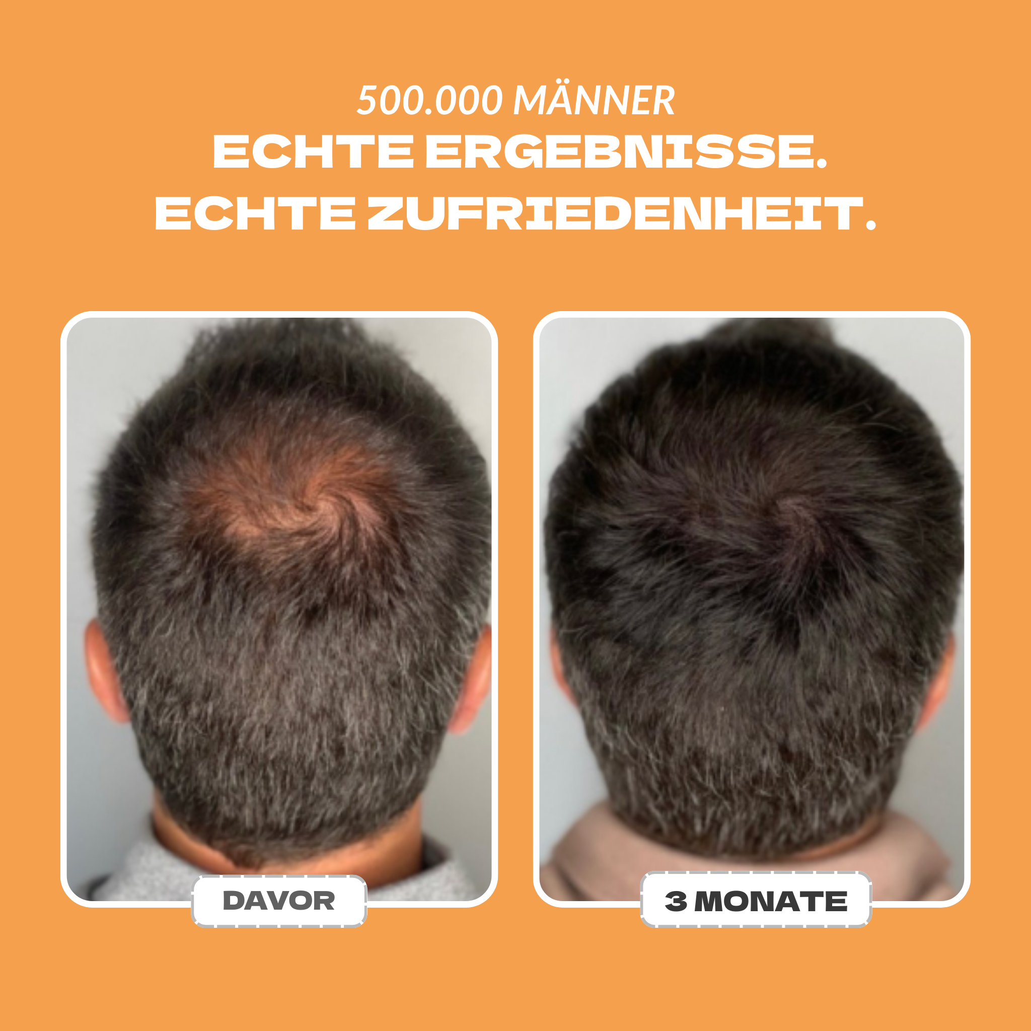Shampoo + Serum
